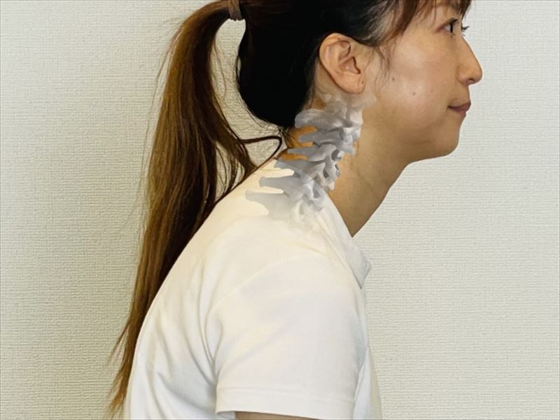 ストレートネック・猫背を根本から改善し、健康的な体へ導きます。